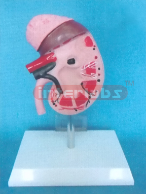 MIDDLE ANATOMICAL KIDNEY MODEL WITH ADRENAL GLAND